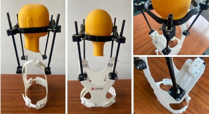 Кейс: использование 3D-принтеров Volgobot А4 PRO и А3 PRO в НП ООО «МЕДБИОТЕХ»