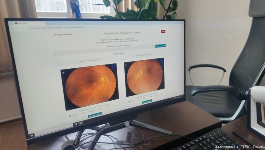 СибГМУ запускает проект дистанционной диагностики осложнений сахарного диабета