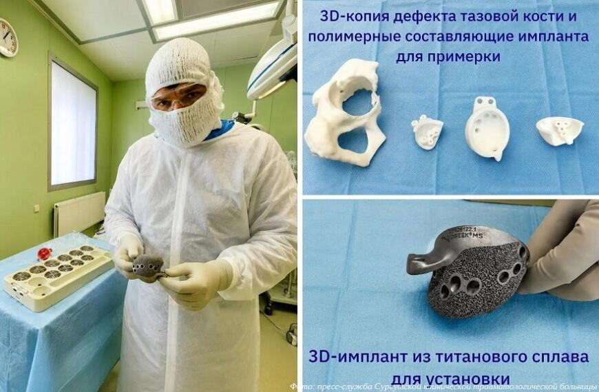 Сургутские травматологи-ортопеды наращивают применение 3D-печатных имплантатов Сургутские травматологи-ортопеды наращивают применение 3D-печатных имплантатов