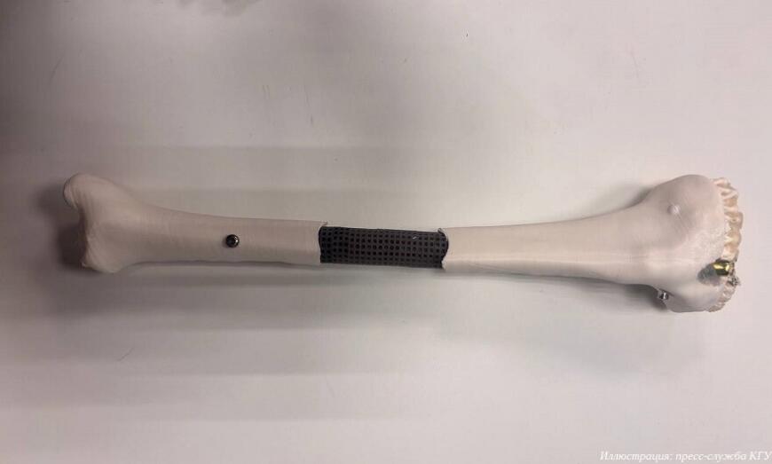 Ученые КГУ и Центра Илизарова создали модульные костные имплантаты Ученые КГУ и Центра Илизарова создали модульные костные имплантаты