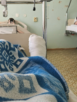 Ортез на 3d принтере, или как я себе жизнь подпортил, а потом облегчил. Ортез на 3d принтере, или как я себе жизнь подпортил, а потом облегчил.