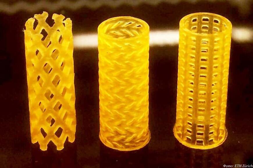 Швейцарские ученые изучили эффективность биорезорбируемых 3D-печатных стентов