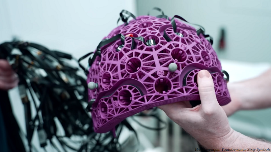 Как аддитивные технологии и 3D-сканер от SHINING 3D помогают изучать работу мозга