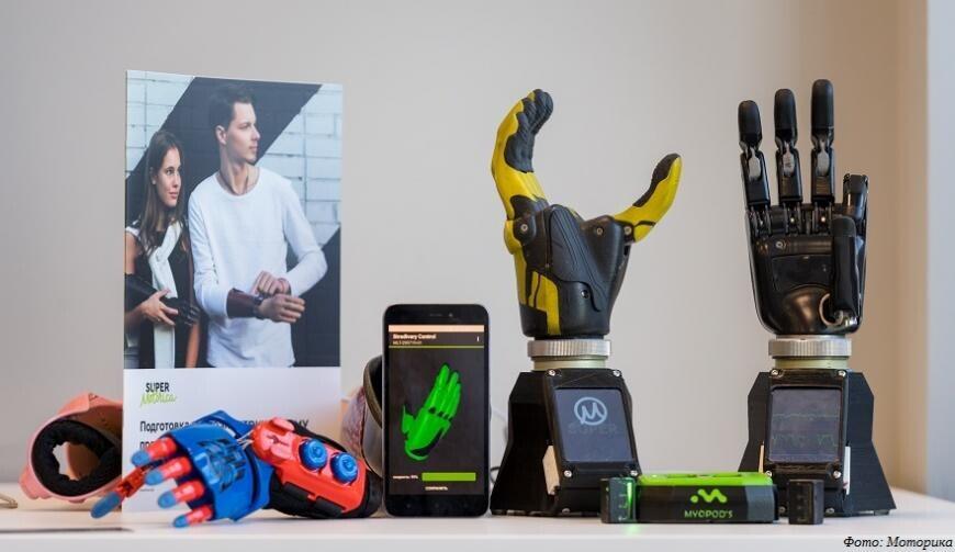 TrueLimb: 3D-печатные бионические протезы от Unlimited Tomorrow