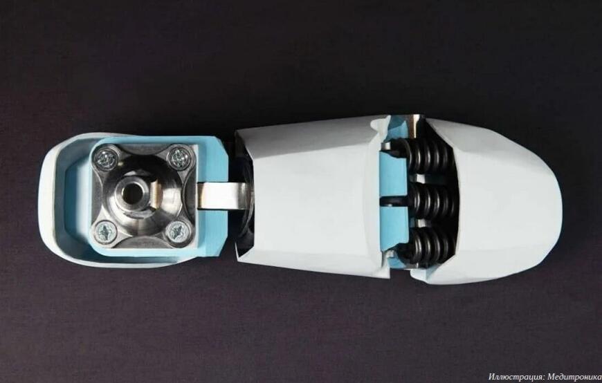Компания «Медитроника» создает 3D-печатные протезы ног