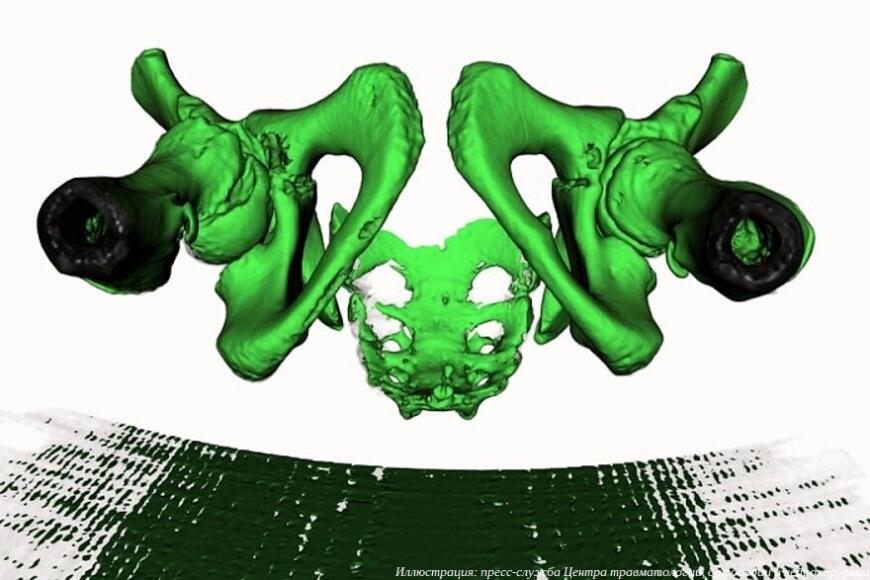 Кировские врачи поделились опытом применения 3D-технологий