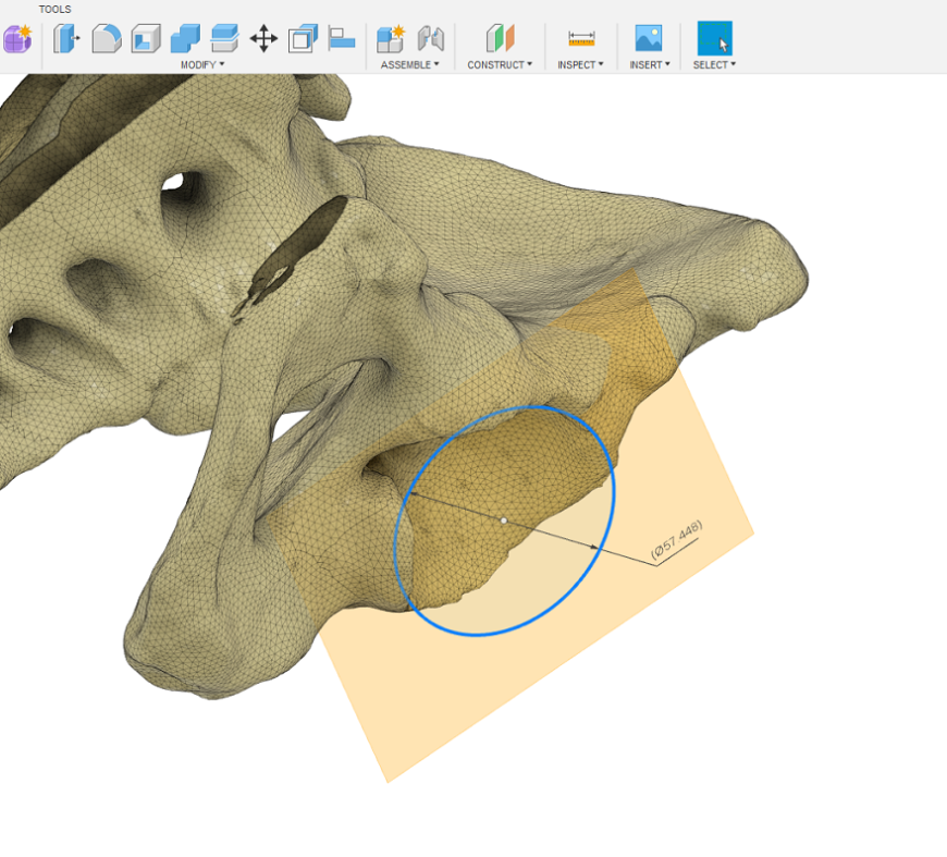 3D-моделирование эндопротеза в Autodesk Fusion 360: история успеха