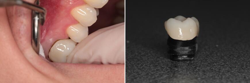 Цифровые инновации в стоматологии сегодня, или как THE ICE dental clinic применяет 3D-печать