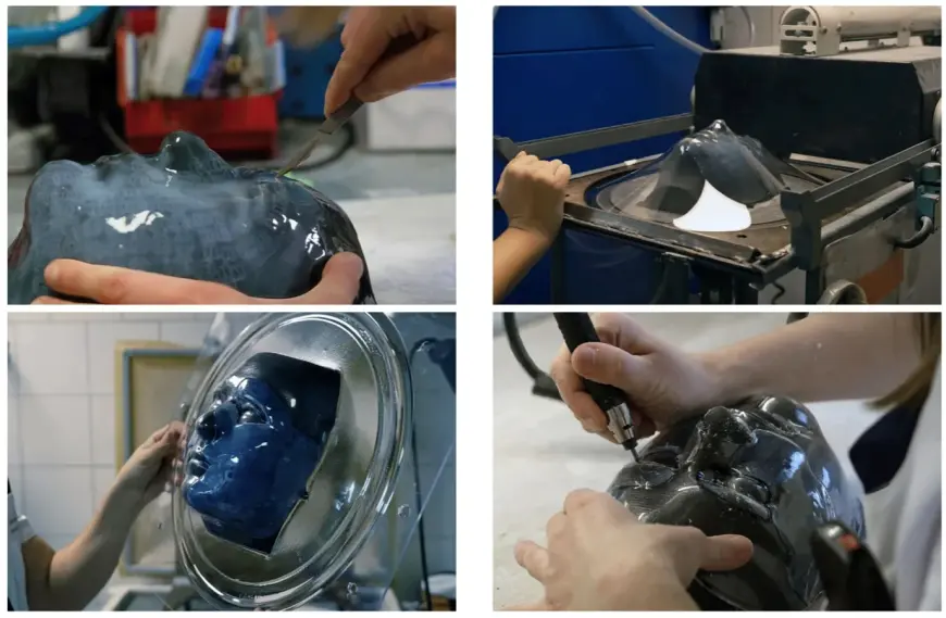 Лечение детей с тяжелыми ожогами с помощью лицевых масок, изготовленных с помощью 3D-печати