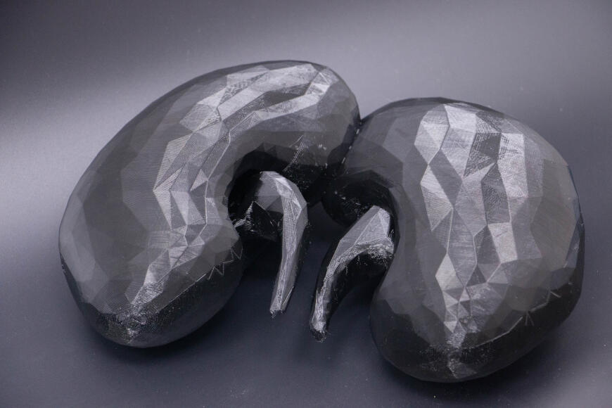 Кейс для клиники - почки в стразах