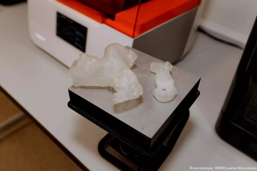 Новосибирские хирурги используют 3D-печатные модели в подготовке к хирургическим операциям
