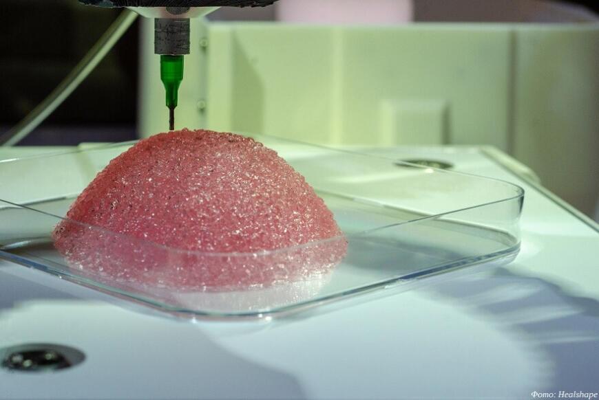 Healshape разрабатывает биорезорбируемые 3D-печатные грудные имплантаты