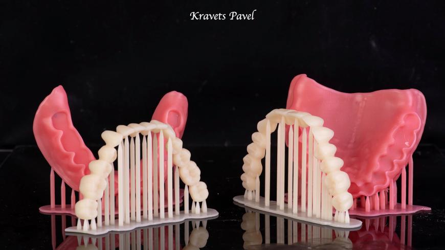 Съемное протезирование в стоматологии