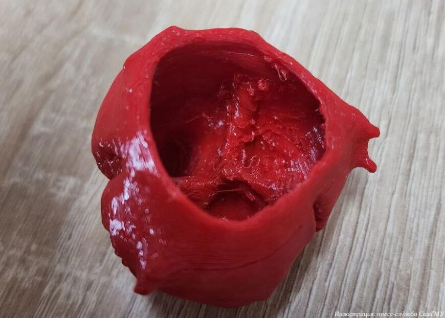 В СамГМУ разрабатывают 3D-печатный бионический клапан сердца