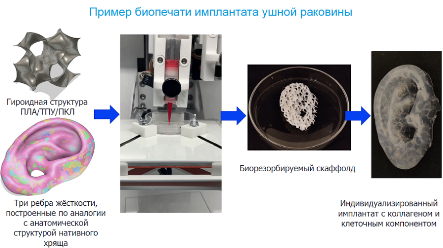 Аддитивные технологии в медицине проект - 87 фото