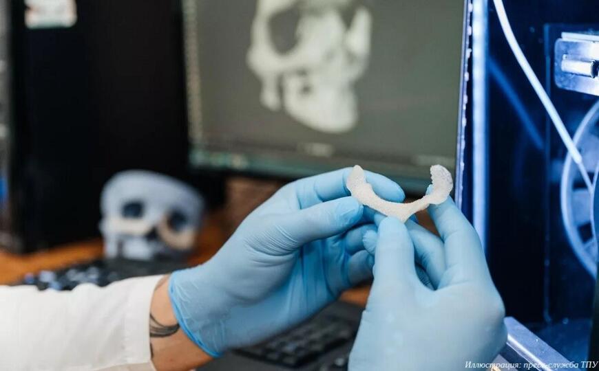 В ТПУ изучают нанесение остеокондуктивных покрытий на 3D-печатные костные имплантаты