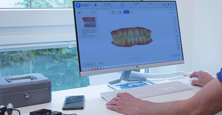 Новинка Aoralscan 3 • Стоматологический 3D сканер от компании Shining 3D • Анонс