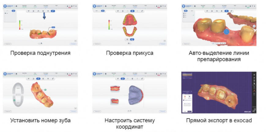 Новинка Aoralscan 3 • Стоматологический 3D сканер от компании Shining 3D • Анонс