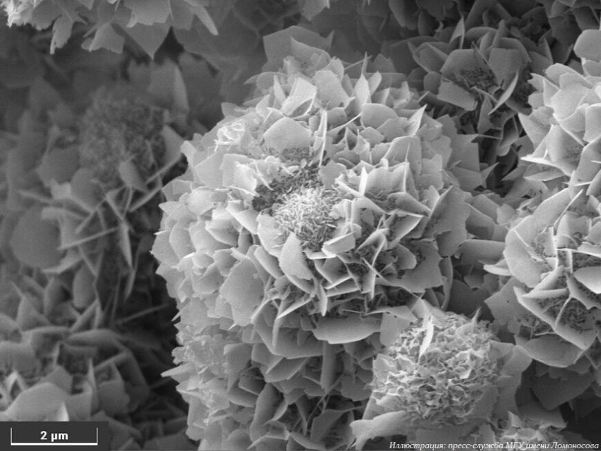 Российские ученые разработали керамические материалы для восстановления костных тканей