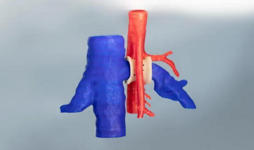 3D-принтеры от Intamsys открывают новые возможности по установке имплантатов из PEEK