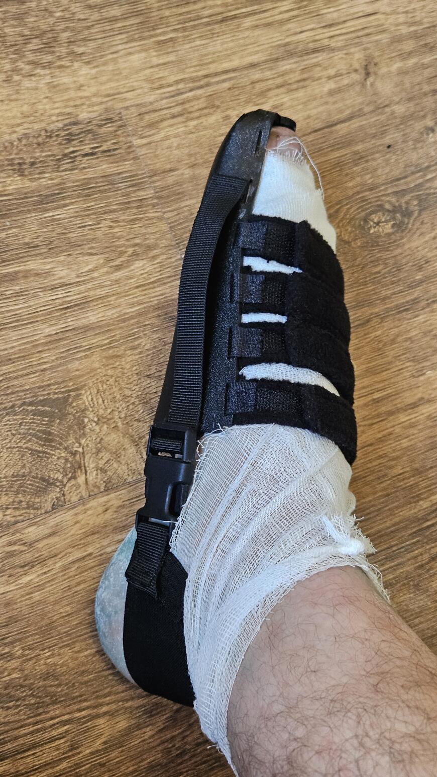 Ортез на 3d принтере, или как я себе жизнь подпортил, а потом облегчил. Ортез на 3d принтере, или как я себе жизнь подпортил, а потом облегчил.