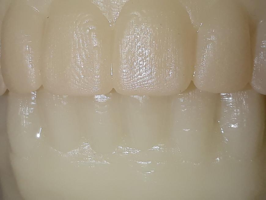 Зубы 50 и 25 микрон, из eSUN Standart Resin White UNIZ Slash PLUS
