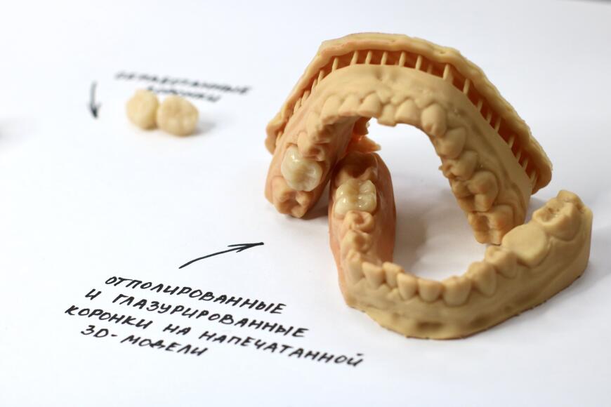 Печать постоянных коронок с Formlabs Permanent Crown Resin Печать постоянных коронок с Formlabs Permanent Crown Resin