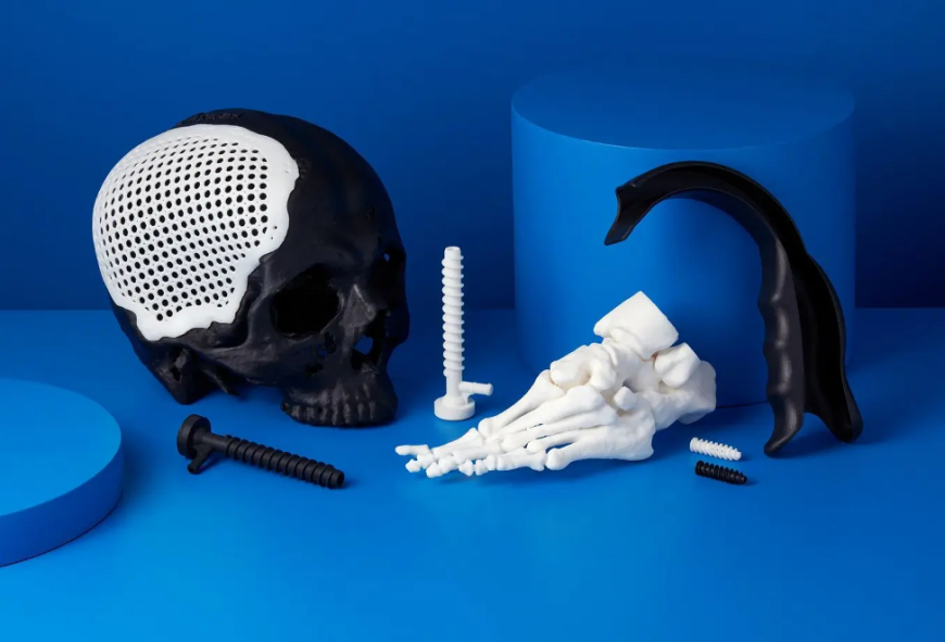 Как сейчас используется 3D-печать в хирургии позвоночника