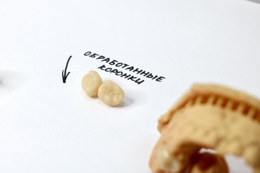 Печать постоянных коронок с Formlabs Permanent Crown Resin Печать постоянных коронок с Formlabs Permanent Crown Resin