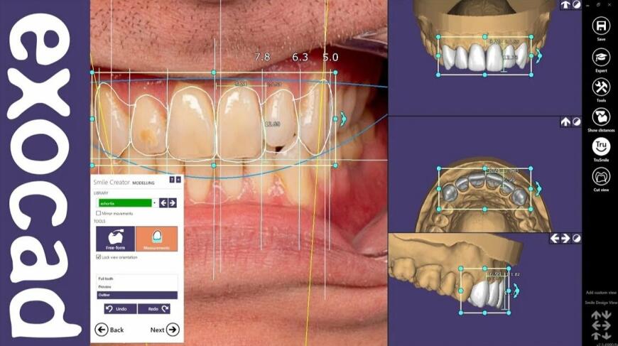 Возможности цифрового производства стоматологии в 2021 году
