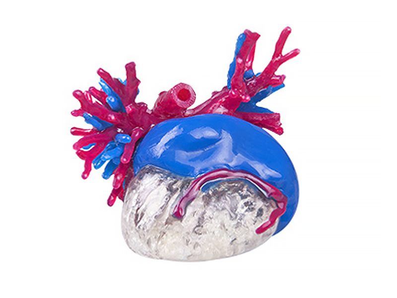 WJP 3D принтеры LIDER-3D в медицине WJP 3D принтеры LIDER-3D в медицине