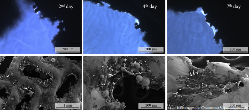 Российские ученые разработали технологию аддитивного производства биомиметических имплантатов с заданной проницаемостью