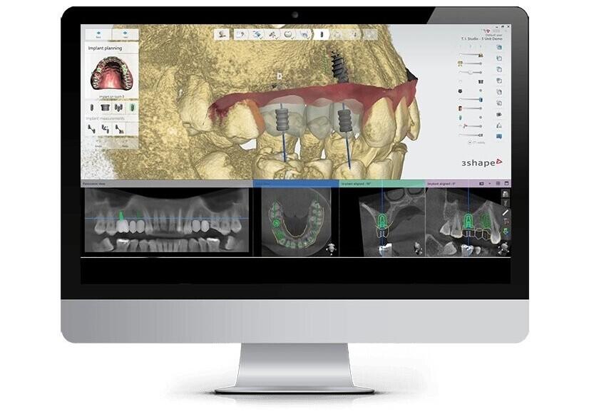 Обзор стоматологических 3D-сканеров компании 3Shape