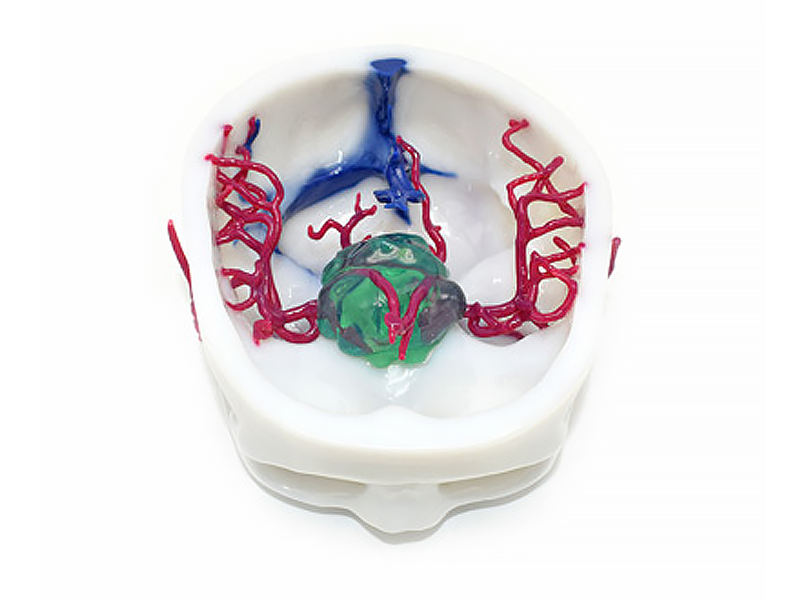 WJP 3D принтеры LIDER-3D в медицине WJP 3D принтеры LIDER-3D в медицине