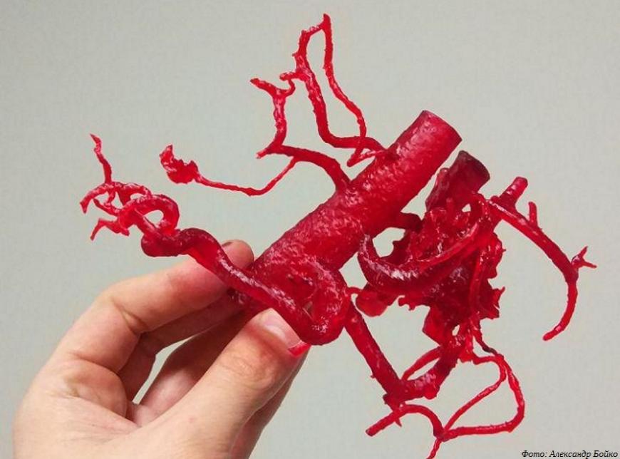Участники фестиваля 3Dtoday Fest расскажут о применении 3D-печати в медицине