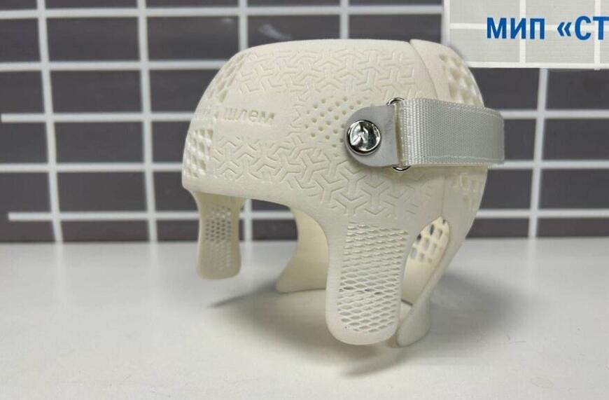 В НМИЦ имени Турнера создали 3D-печатные ортопедические шлемы В НМИЦ имени Турнера создали 3D-печатные ортопедические шлемы