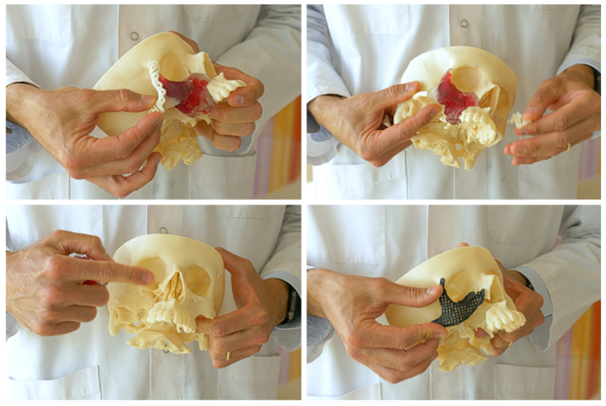 Детская больница SJD Barcelona печатает анатомические модели для планирования и моделирования сложных операций
