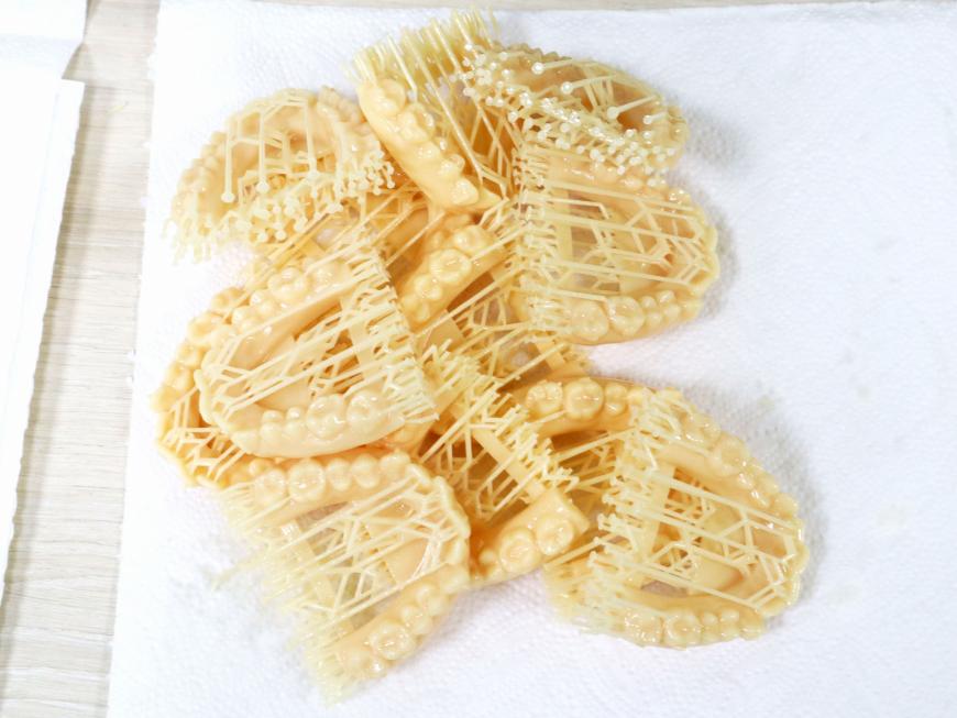 Двухуровневые зубки для элайнеров на 3D принтере Phrozen Sonic