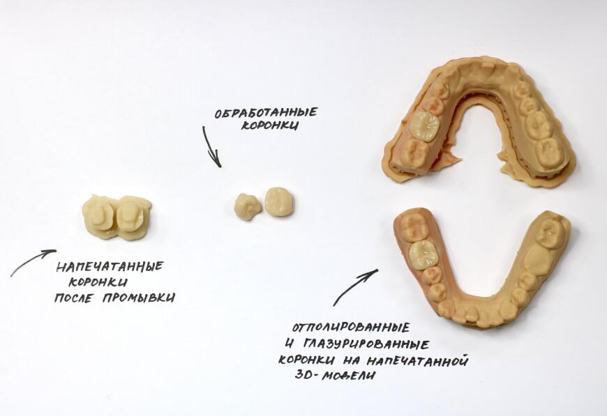 Печать постоянных коронок с Formlabs Permanent Crown Resin Печать постоянных коронок с Formlabs Permanent Crown Resin