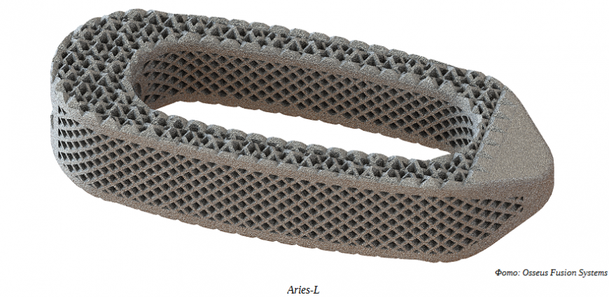 Osseus Fusion Systems предлагает 3D-печатные межпозвонковые имплантаты