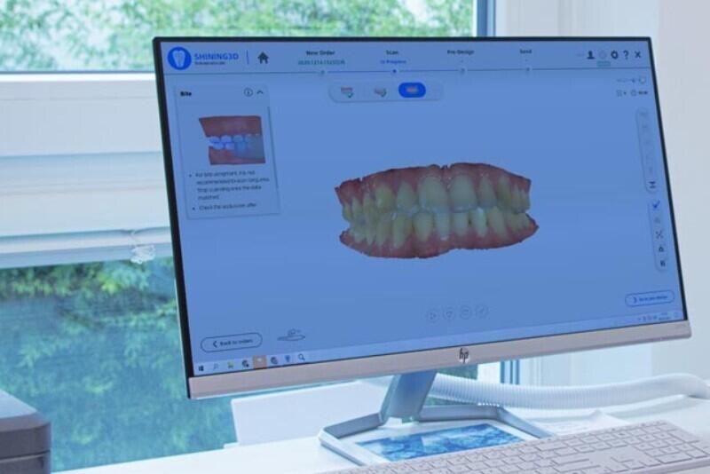 ТОП лучших стоматологических 3D сканеров 2022