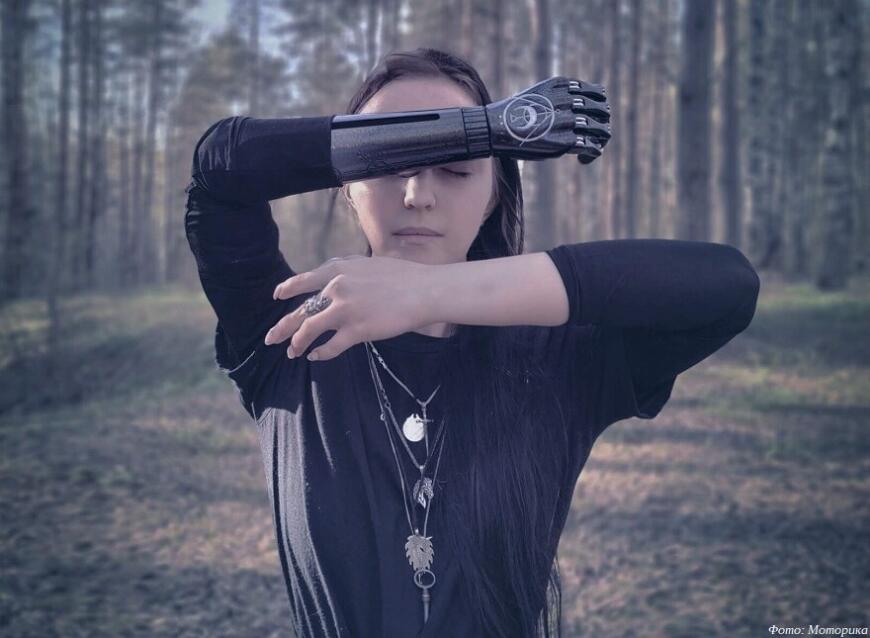 Житель Карелии получил 3D-печатный бионический протез руки