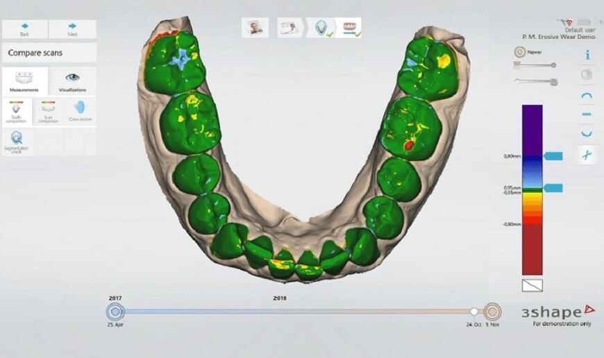 Обзор стоматологических 3D-сканеров компании 3Shape