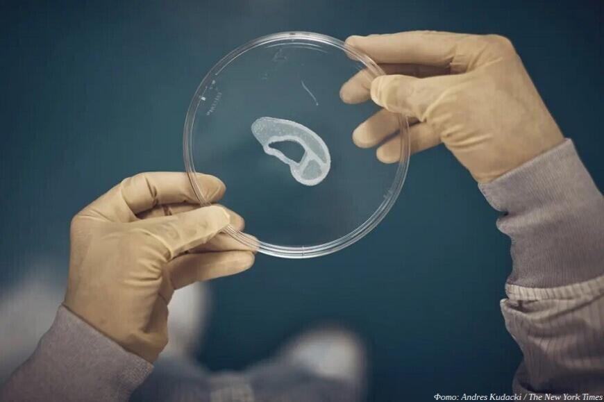 Молодые ученые МИСиС и Университета Косыгина разработали 3D-печатный имплантат ушной раковины