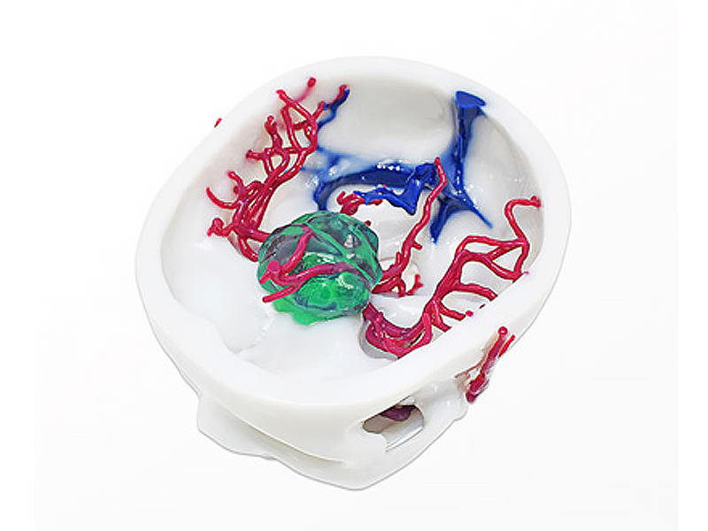 WJP 3D принтеры LIDER-3D в медицине WJP 3D принтеры LIDER-3D в медицине