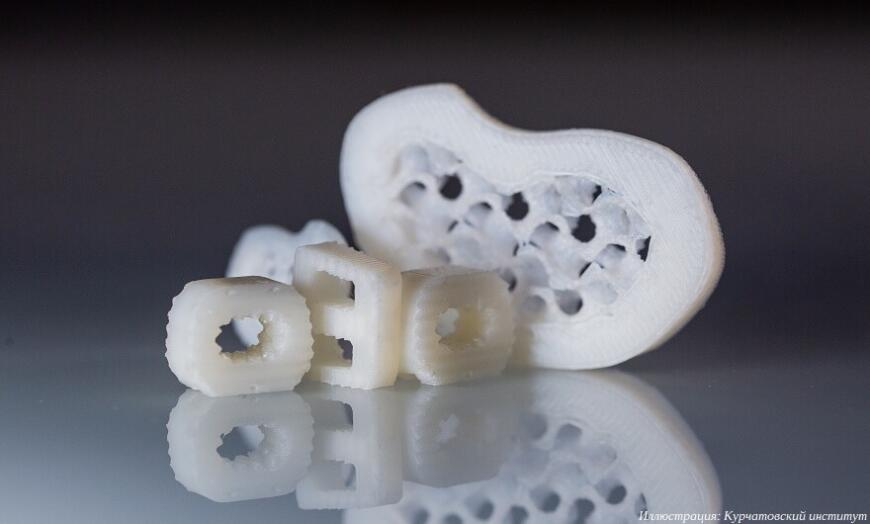 Курчатовский институт работает над 3D-печатными биоразлагаемыми спинальными кейджами