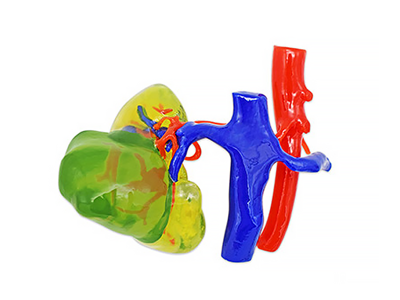 WJP 3D принтеры LIDER-3D в медицине WJP 3D принтеры LIDER-3D в медицине