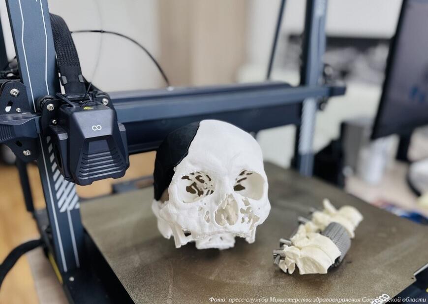 Екатеринбургские нейрохирурги используют 3D-печатные анатомические модели для предоперационного планирования