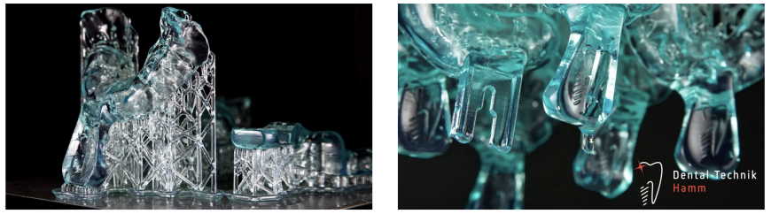 От новичка до эксперта в области 3D: 20 лет цифровой стоматологии в компании Dental-Technik Hamm