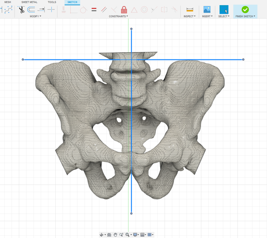 3D-моделирование эндопротеза в Autodesk Fusion 360: история успеха